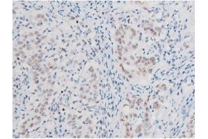 Immunohistochemistry (IHC) image for anti-LIM Domain Kinase 2 (LIMK2) (pSer283) antibody (ABIN6256239)