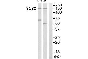 Western Blotting (WB) image for anti-Son of Sevenless Homolog 2 (SOS2) (Internal Region) antibody (ABIN1852212) (SOS2 Antikörper  (Internal Region))