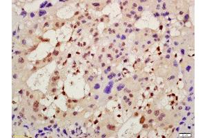 Formalin-fixed and paraffin embedded mouse placenta labeled with Rabbit Anti-AMIGO2 Polyclonal Antibody, Unconjugated (ABIN1386548) at 1:200 followed by conjugation to the secondary antibody and DAB staining (AMIGO2 Antikörper  (AA 21-120))