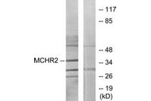 Western blot analysis of extracts from HuvEc cells, using MCHR2 Antibody.