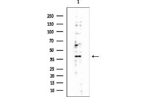 anti-EBNA1 Binding Protein 2 (EBNA1BP2) (Internal Region) antibody