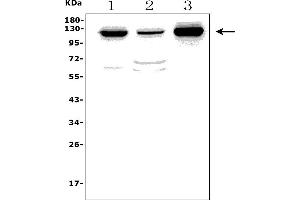 Western blot analysis of MORC3 using anti-MORC3 antibody (ABIN7602764).