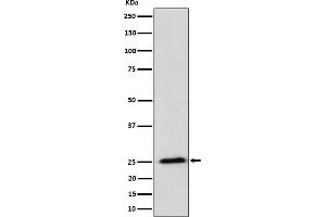 Western blot analysis of RPL10A expression in HeLa cell lysate.