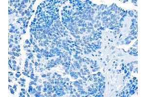 Immunohistochemistry (IHC) image for anti-Bromodomain Containing 3 (BRD3) (AA 676-726) antibody (ABIN7454022) (Rekombinanter BRD3 Antikörper  (AA 676-726))