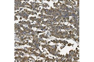 IHC analysis of ALDH1L1 using anti-ALDH1L1 antibody (ABIN7601093). (ALDH1L1 Antikörper  (AA 282-424))