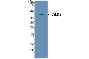 Western blot analysis of recombinant Human APOC2. (Apolipoprotein C-II Antikörper  (AA 13-97))