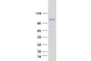 Western Blotting (WB) image for Serpin Peptidase Inhibitor, Clade G (C1 Inhibitor), Member 1 (SERPING1) (Transcript Variant 2) protein (Myc-DYKDDDDK Tag) (ABIN2731839)