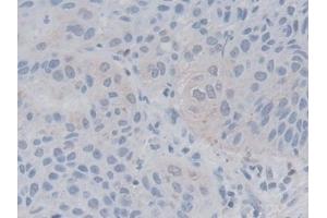 Immunohistochemistry (IHC) image for anti-Lactamase, beta (LACTB) (AA 313-547) antibody (ABIN7436687)