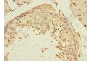 Immunohistochemistry of paraffin-embedded human testis tissue using ABIN7172192 at dilution of 1:100 (TIGD4 Antikörper  (AA 301-512))