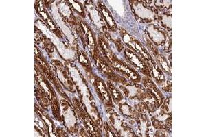 Immunohistochemical staining of human kidney with PRDM12 polyclonal antibody  shows strong cytoplasmic positivity in cells in tubules at 1:10-1:20 dilution. (PRDM12 Antikörper)