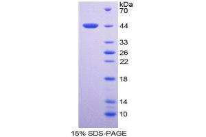 SDS-PAGE (SDS) image for Cardiac Troponin T (cTnT) (AA 2-100) protein (His tag,GST tag) (ABIN1171504)