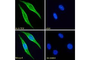 ABIN6391363 Immunofluorescence analysis of paraformaldehyde fixed NIH3T3 cells, permeabilized with 0. (Doublecortin Antikörper  (Internal Region))
