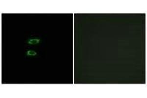 Immunofluorescence analysis of A549 cells, using BMP8A antibody. (BMP8A Antikörper  (C-Term))