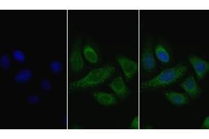 Detection of LPL in Human Hela cell using Polyclonal Antibody to Lipoprotein lipase (LPL) (Lipoprotein Lipase Antikörper  (AA 28-474))