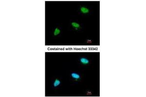 ICC/IF Image Immunofluorescence analysis of paraformaldehyde-fixed A549, using CDC34, antibody at 1:200 dilution. (CDC34 Antikörper)