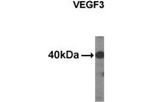 Western Blotting (WB) image for anti-Vascular Endothelial Growth Factor C (VEGFC) antibody (ABIN2995286) (VEGFC Antikörper)