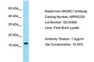 Image no. 1 for anti-Vitamin K Epoxide Reductase Complex, Subunit 1 (VKORC1) (AA 27-76) antibody (ABIN6749969) (VKORC1 Antikörper  (AA 27-76))