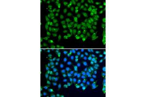 Immunofluorescence analysis of MCF-7 cells using RNF8 antibody (ABIN5974404). (RNF8 Antikörper)