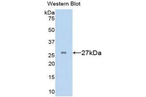 Western blot analysis of the recombinant protein. (Clusterin Antikörper  (AA 227-447))