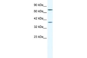 WB Suggested Anti-ZNF660 Antibody Titration:  1. (ZNF660 Antikörper  (C-Term))