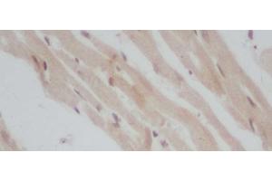 Immunohistochemistry of paraffin-embedded Mouse heart using ERG Polyclonal Antibody at dilution of 1:50 (ERG Antikörper)