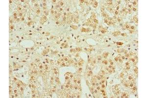 Immunohistochemistry of paraffin-embedded human adrenal gland tissue using ABIN7148657 at dilution of 1:100 (CFDP1 Antikörper  (AA 1-299))