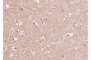 ABIN6268670 at 1/100 staining human brain tissue sections by IHC-P. (Angiopoietin 2 Antikörper  (N-Term))