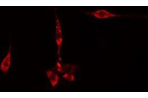 ABIN6275616 staining  CoLo205 cells by IF/ICC. (SYT11 Antikörper  (Internal Region))
