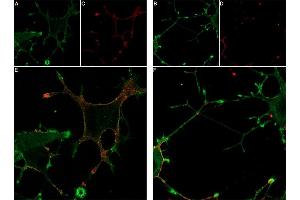 Live cell imaging of GsMTx-4-ATTO Fluor-647N in differentiated  cells.