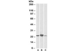 Western blot testing of human [A], mouse [B], rat [C] liver lysate with ABHD14B antibody at 0. (ABHD14B Antikörper)