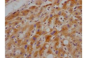 IHC image of ABIN7127528 diluted at 1:100 and staining in paraffin-embedded human liver tissue performed on a Leica BondTM system. (Rekombinanter Growth Hormone Receptor Antikörper)