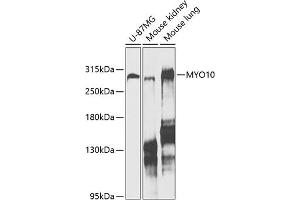 Western blot analysis of extracts of various cell lines, using MYO10 antibody (ABIN6128319, ABIN6144271, ABIN6144274 and ABIN6216113) at 1:1000 dilution.