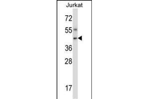 Mouse Nim1 Antibody (C-term) (ABIN657849 and ABIN2846810) western blot analysis in Jurkat cell line lysates (35 μg/lane). (NIM1 Antikörper  (C-Term))