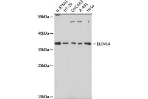 Western blot analysis of extracts of various cell lines, using ELOVL4 antibody (ABIN1679709, ABIN3017923, ABIN3017924 and ABIN6220305) at 1:3000 dilution. (ELOVL4 Antikörper  (AA 1-100))