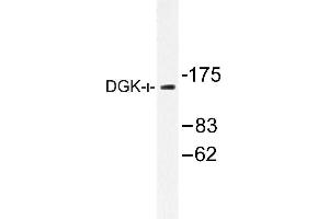 Image no. 1 for anti-Diacylglycerol Kinase, iota (DGKI) antibody (ABIN272146)