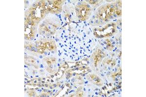 Immunohistochemistry of paraffin-embedded rat kidney using NIN antibody (ABIN5974918) at dilution of 1/100 (40x lens). (Ninein Antikörper)