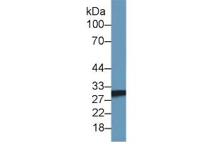 SDHB anticorps  (AA 97-282)