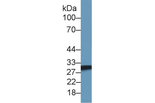 SDHB anticorps  (AA 97-282)