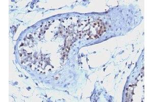 Formalin-fixed, paraffin-embedded human testicular carcinoma stained with Cyclin B1 antibody. (Cyclin B1 Antikörper)