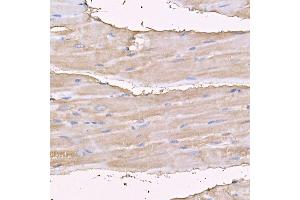Immunohistochemistry (IHC) image for anti-Myosin Heavy Chain 4, Skeletal Muscle (MYH4) (AA 1450-1550) antibody (ABIN7268749)