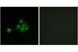 Immunofluorescence analysis of MCF7 cells, using IRS-1 (Phospho-Ser636) Antibody. (IRS1 Antikörper  (pSer636))