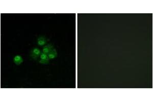 Immunofluorescence analysis of MCF7 cells, using IRS-1 (Phospho-Ser636) Antibody.