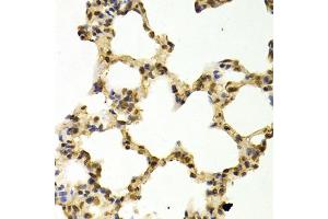 Immunohistochemistry of paraffin-embedded rat lung using DNMT3A Antibody (ABIN1872325) at dilution of 1:100 (40x lens). (DNMT3A Antikörper)