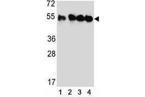Western blot analysis of TUBB2C antibody and (1) HeLa, (2) MDA-MB435, (3) MDA-MB231, and (4) HepG2 lysate. (TUBB2C Antikörper  (AA 99-125))