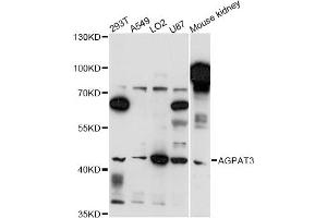 Western blot analysis of extracts of various cell lines, using AGPAT3 antibody (ABIN6291715) at 1:3000 dilution. (AGPAT3 Antikörper)
