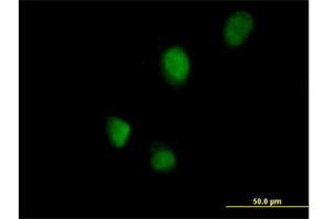 Immunofluorescence of purified MaxPab antibody to RNF113B on HeLa cell. (RNF113B Antikörper  (AA 1-322))