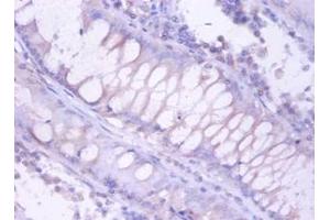 Immunohistochemistry (IHC) image for anti-Proteasome (Prosome, Macropain) Subunit, beta Type, 4 (PSMB4) antibody (FITC) (ABIN2577401)