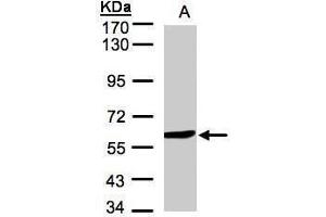 WB Image Sample(30 μg of whole cell lysate) A:Hep G2, 7. (Monoamine Oxidase B Antikörper)