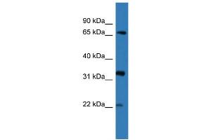 WB Suggested Anti-DOK4  Antibody Titration: 0. (DOK4 Antikörper  (N-Term))