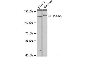 Western blot analysis of extracts of various cell lines using PDE6A Polyclonal Antibody at dilution of 1:1000. (PDE6A Antikörper)